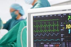 Cứ 1 triệu người dân Việt lại có gần 15.500 người đang sống chung với đột quỵ