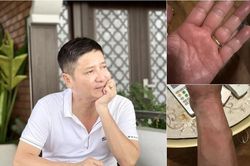 Căn bệnh NSƯT Chí Trung phải chung sống khổ sở suốt nửa năm có thật sự lạ?
