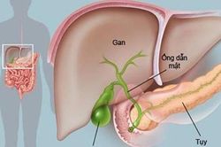 6 dấu hiệu ung thư tụy, nhận biết sớm để điều trị kịp thời
