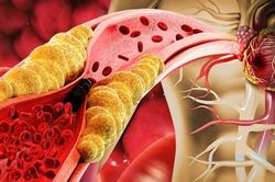 Ăn nửa quả này mỗi ngày cũng đủ trẻ hóa mạch máu, ngăn ngừa xơ cứng động mạch
