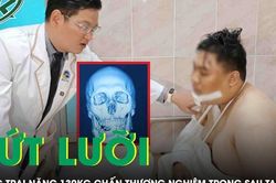 Cứu chàng trai nặng 130 kg đứt lưỡi sau tai nạn giao thông