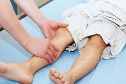 Trẻ bị đau chân sau sốt cao do biến chứng tiêu cơ vân nguy hiểm