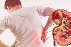 7 thói quen âm thầm làm suy yếu thận, nam giới cần thay đổi sớm