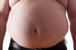 Người đàn ông bụng phình to như 'mang thai', bác sĩ lấy ra thứ 'đáng sợ' nặng 20kg