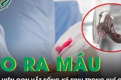 Ho ra máu suốt một tháng, bàng hoàng phát hiện con vắt sống ký sinh trong khí quản