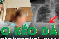 Ho kéo dài nhiều tuần, người phụ nữ bất ngờ phát hiện phổi trái xẹp hoàn toàn vì bệnh hiếm