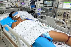 Nắng nóng, thiếu niên 15 tuổi sốc nhiệt nguy kịch, tổn thương gan, thận khi chơi thể thao