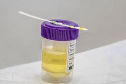 Vì sao dùng ma túy nhưng test nhanh vẫn âm tính?