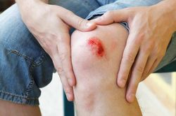 Điều xảy ra khi cơ thể thiếu kẽm