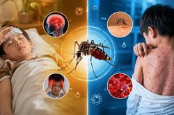 Đừng xem nhẹ những cơn sốt mùa hè