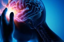 Cơn thiếu m&aacute;u n&atilde;o tho&aacute;ng qua: Dấu hiệu cảnh b&aacute;o sớm nguy cơ đột quỵ