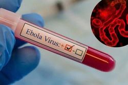 Dịch bệnh Ebola diễn biến phức tạp tại Châu Phi nhưng người dân không nên hoang mang