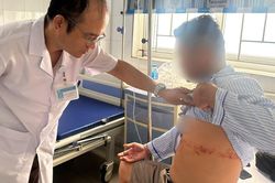 Bệnh nhân mô tả cơn đau khủng khiếp của zona thần kinh