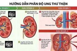 Đau lưng kéo dài, người đàn ông 45 tuổi phát hiện ung thư thận