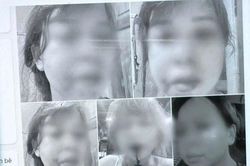 Người phụ nữ ở Đắk Lắk tố bị chồng hành hung khi con mới 2 tháng tuổi