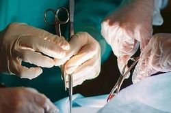 Người phụ nữ 39 tuổi phải cắt cụt chân sau khi cho chó ăn