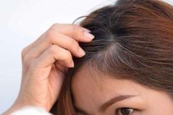 Tóc bạc sớm ở người trẻ ngày càng phổ biến: Chuyên gia cảnh báo nhiều nguyên nhân ít ai ngờ tới