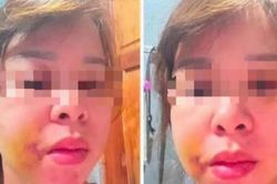 Người mẹ 3 con ở Đắk Lắk cầu cứu sau nhiều lần bị chồng hành hung