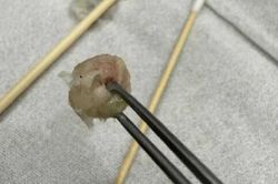 Bé gái 6 tuổi nhập viện khẩn cấp, bố mẹ 'sốc' khi bác sĩ lấy ra thứ 'đáng sợ' từ mũi con