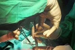 Bé trai 3 tuổi nôn ra giun, khi phẫu thuật bác sĩ phát hiện điều đáng sợ hơn
