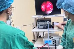 Nữ sinh 18 tuổi đau đầu suốt 3 năm vì chủ quan với viêm xoang mạn tính