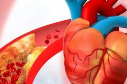 Biện pháp phòng ngừa bệnh tim mạch hiệu quả sau tuổi 30