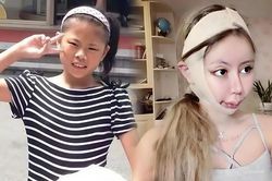 Cô gái 18 tuổi 'dao kéo' hơn 100 lần giờ ra sao?