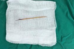 Bác sĩ sốc khi phát hiện chiếc tăm tre cắm trong tim bé trai 13 tuổi