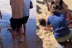 Rùng mình khoảnh khắc cô gái 19 tuổi ở Brazil bị cá mập tấn công, đứt chân phải khi đang tắm biển