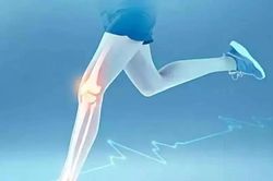 6 hiểu lầm tai hại về lo&atilde;ng xương