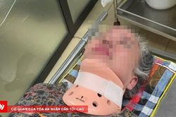 Xô xát vì mâu thuẫn nợ nần, người phụ nữ phải nhập viện điều trị