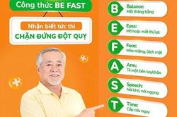 Bạn đã biết cách đơn giản để xác định đột quỵ chưa?