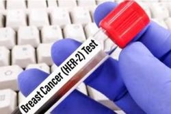 FDA ưu ti&ecirc;n xem x&eacute;t đơn đăng k&yacute; thuốc giredestrant của Roche trong điều trị ung thư v&uacute;