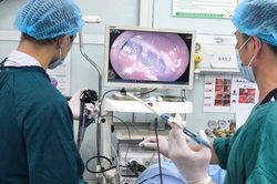 Mệt mỏi, sụt cân sau thời gian dài táo bón, người phụ nữ 48 tuổi nhận kết quả không ngờ