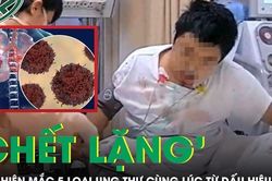 Người đàn ông 'chết lặng' phát hiện mắc 5 loại ung thư cùng lúc chỉ từ dấu hiệu này