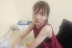 Bắt giữ đối tượng trộm cắp tài sản tại cơ sở nha khoa