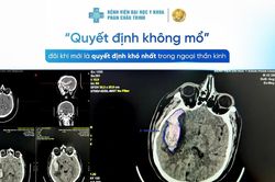 Quyết định không mổ đôi khi là quyết định khó nhất trong Ngoại thần kinh