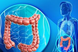 Bác sĩ cảnh báo dấu hiệu ung thư đại trực tràng dễ bị bỏ qua