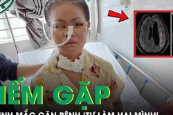 Nữ sinh 19 tuổi mắc căn bệnh 'tự làm hại mình' hiếm gặp