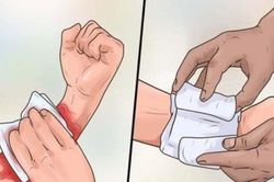 Đắp lá chữa vết thương, bệnh nhân tử vong vì uốn ván