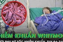 Người phụ nữ 43 tuổi sốc nhiễm khuẩn, suy đa tạng sau 5 ngày sốt