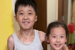 Cậu bé bỏng 97% cơ thể và giấc mơ thành nhà vô địch cầu lông