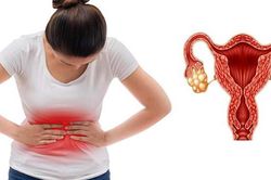 Người phụ nữ 25 tuổi mắc hội chứng buồng trứng đa nang vẫn sinh con khỏe mạnh nhờ làm điều này