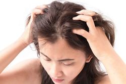 Tưởng gội đầu là sạch gàu, ai ngờ chính thói quen này lại khiến da đầu bong tróc nhiều hơn