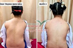 Tìm hiểu nguyên lý 'Khai thông cột sống' của Lão Nhà Quê