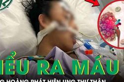 Người đàn ông 51 tuổi bàng hoàng phát hiện ung thư thận từ dấu hiệu tiểu ra máu