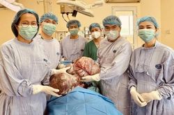 Phẫu thuật thành công cho nữ sinh mang hai khối u buồng trứng khổng lồ nặng gần 15kg