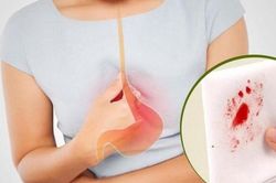Người phụ nữ 63 tuổi phát hiện ung thư dạ dày từ dấu hiệu nhiều người Việt thường bỏ qua