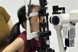 Nhiều trẻ được chỉnh lác mắt thành công nhờ phát hiện sớm