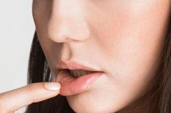 Bác sĩ cảnh báo: Đừng tưởng chỉ là nhiệt miệng, vết loét nhỏ trên lưỡi có thể là ung thư lưỡi giai đoạn sớm!
